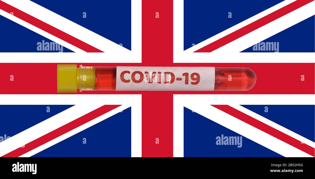 Regno Unito Coronavirus COVID-19 World Outbreak Concept. Provetta Vacutainer per sangue con campione positivo per il virus 2019-nCoV prima dell'indicatore UK. Foto Stock