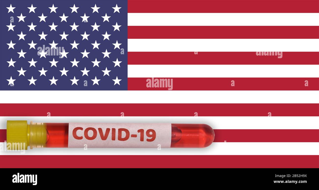 USA Coronavirus COVID-19 World Outbreak Concept. Provetta Vacutainer con campione positivo per il virus 2019-nCoV prima della bandiera degli Stati Uniti d'America. Foto Stock
