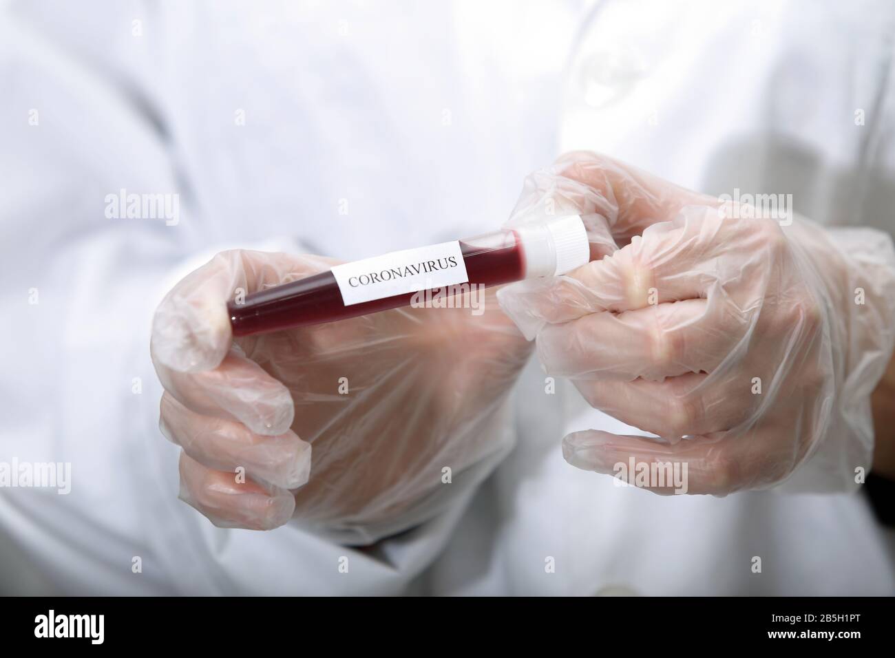 coronavirus - covid-19 - primo piano sulla provetta con prelievo ematico per l'analisi - simulazione Foto Stock