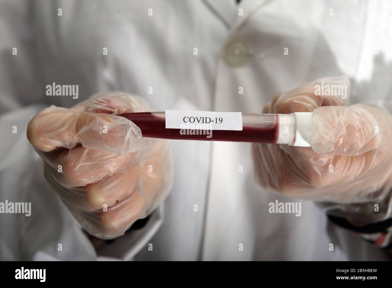 coronavirus - covid-19 - primo piano sulla provetta con prelievo ematico per l'analisi - simulazione Foto Stock