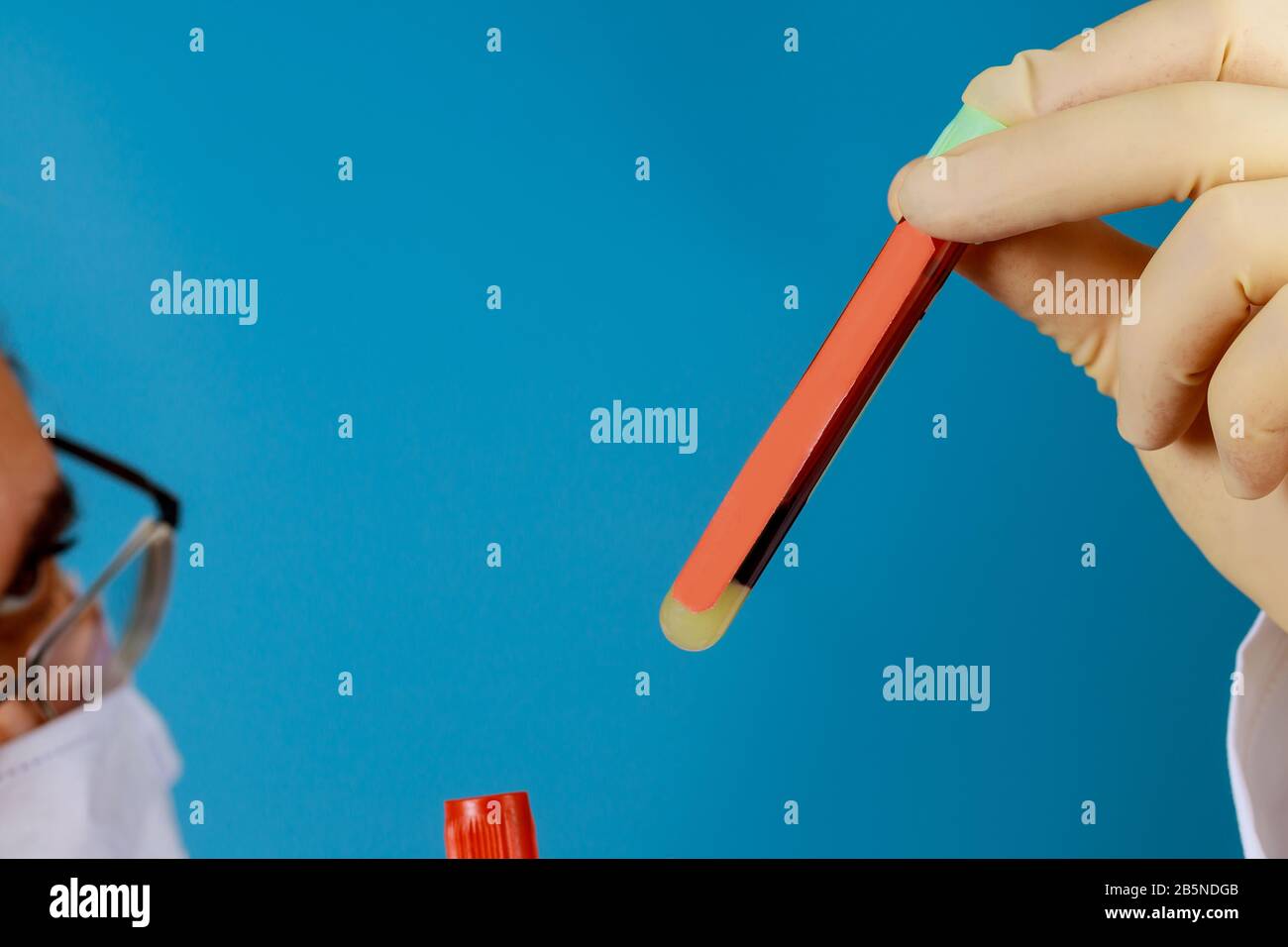 Medico con guanto in lattice di contenimento di un flacone di campione di sangue Foto Stock