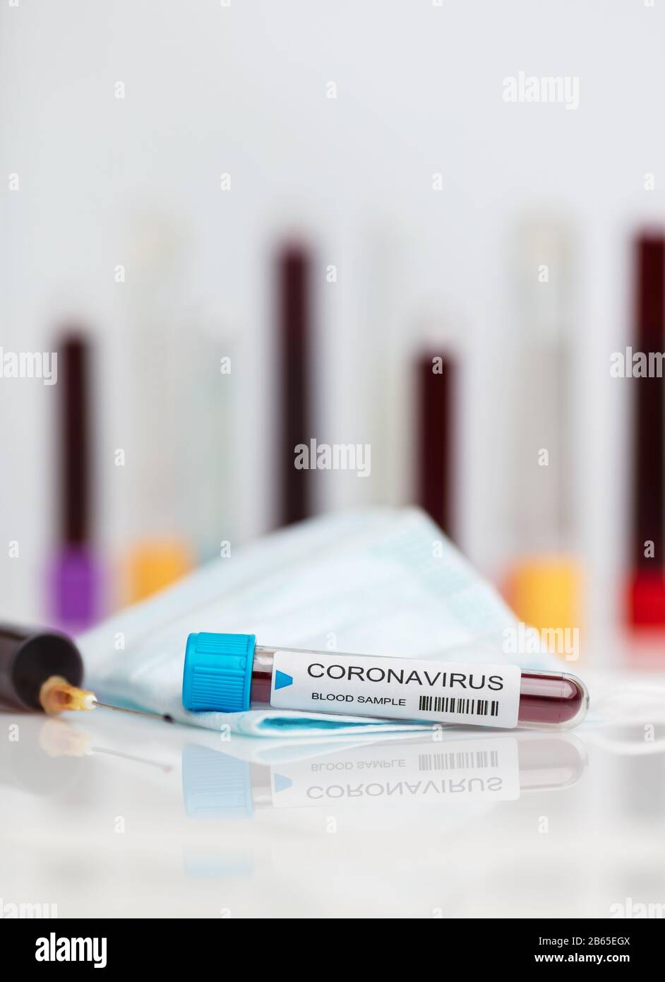 Test del campione di laboratorio del romanzo Coronavirus Foto Stock