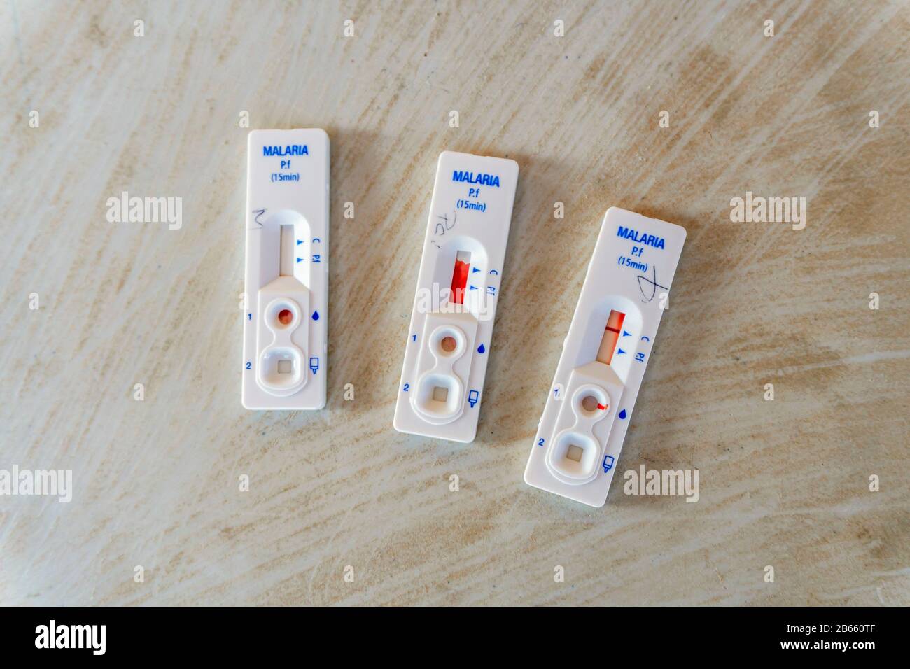 Risultati di test rapidi sulla malaria dal sangue, Lebombo Border Control, Sudafrica Foto Stock