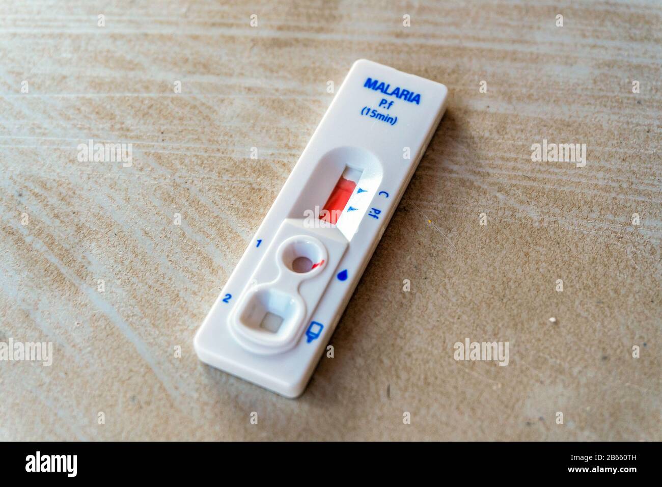 Risultati di test rapidi sulla malaria dal sangue, Lebombo Border Control, Sudafrica Foto Stock