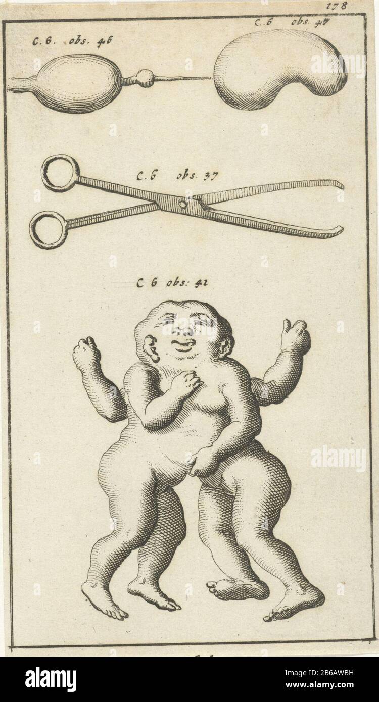 Immagine anatomica XV Stampa a destra 178. Produttore : produttore di stampa: Zwansvliet Editore: John Claesz al Luogo Di Produzione: Amsterdam Data: 1680 - 1688 caratteristiche Fisiche: Materiale di incisione: Tecnica della carta: Dimensioni di incisione: Foglio: 136 mm × h b 80 mmToelichtingIllustratie elencato in: Blankaart, Steven. Collectanea medico-fisica, oft Hollands registro annuale del farmaco e della natura esperta nelle note tecniche, 3 parti, vol. II, fol. 178. Amsterdam: Jan Claesz A Hoorn, 1680-1688. Oggetto: Modelli anatomici (di solito serie di cinque figure) biologia Foto Stock