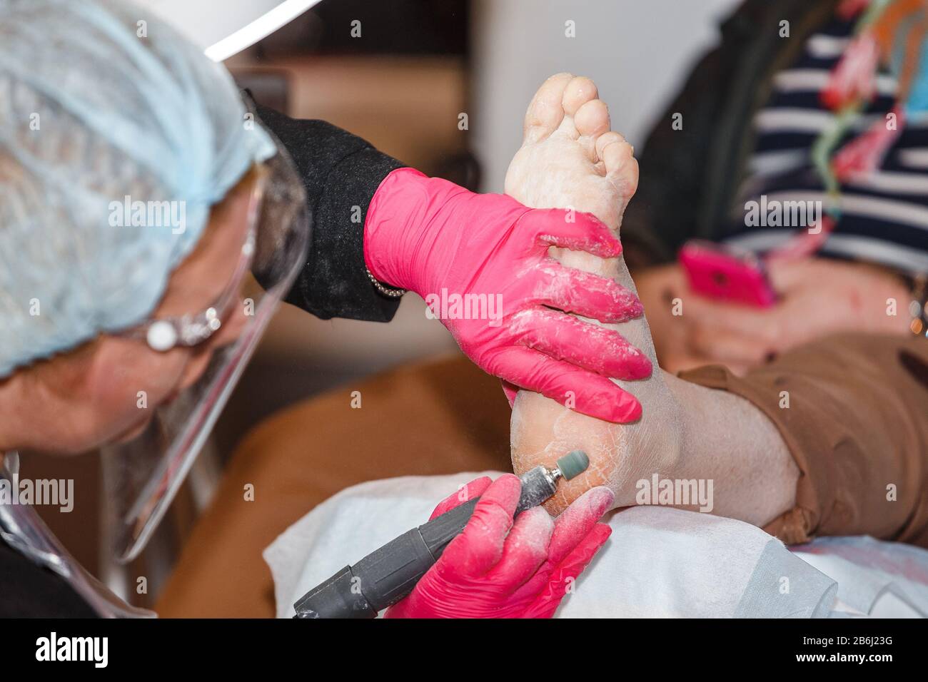 Lo specialista pedicure esegue la procedura di pulizia della pelle problematica sul piede e sui talloni del cliente Foto Stock