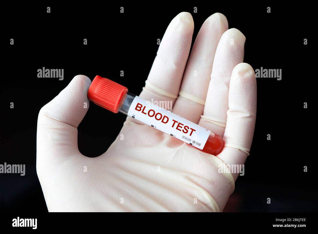 Il medico tiene una bottiglia di campione di sangue su sfondo nero. Controllo dello zucchero nel sangue. Esame del sangue per il virus. Campione di sangue. Foto Stock