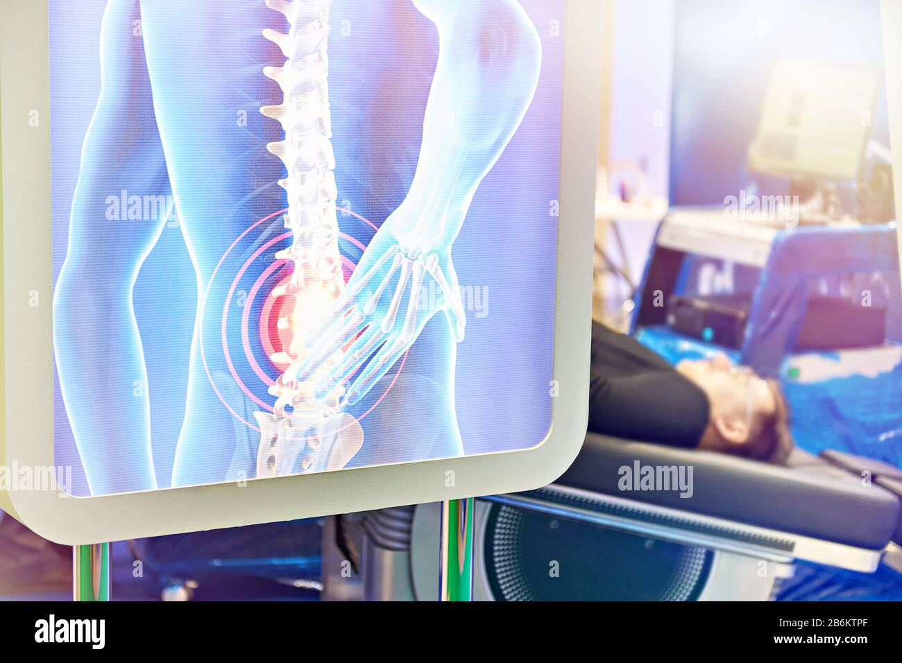 Diagnosi medica moderna della colonna vertebrale Foto Stock