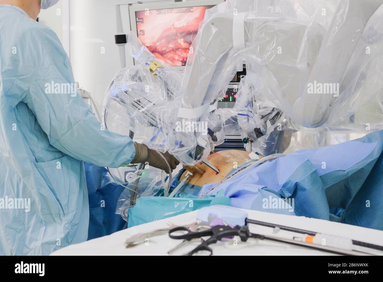 Il processo di esecuzione di un intervento chirurgico utilizzando un moderno sistema chirurgico robotico. Robot medico. Chirurgia robotica minimamente invasiva. Foto Stock