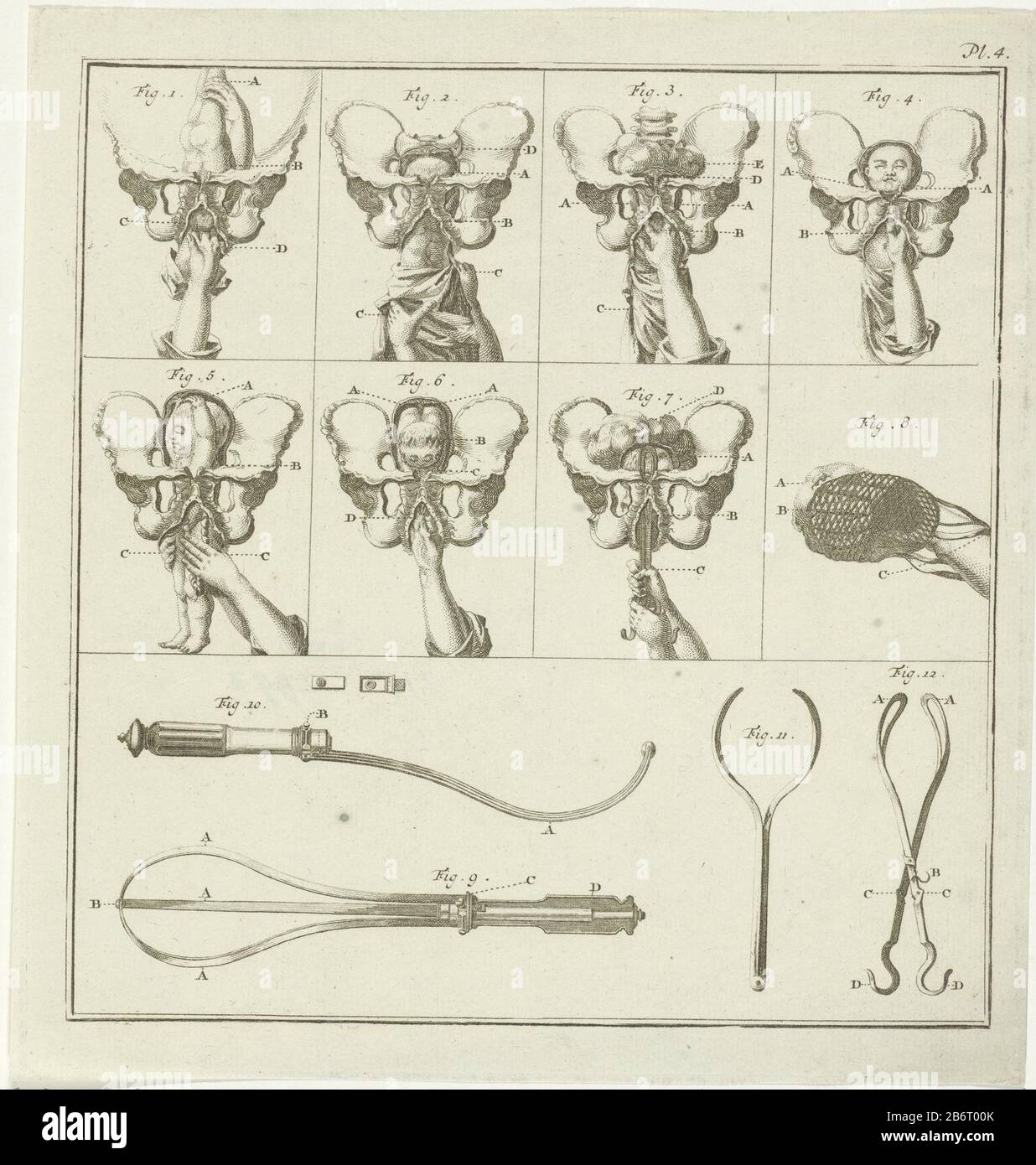 Gynecologische voorstellingen spettacoli ginecologici, con numeri e lettere. Stampa a destra con etichetta: PL. 4. Produttore : tipografia: Nicholas of Frankendaal alla progettazione: C. Plover Data: 1730 - 1791 caratteristiche Fisiche: Acquaforte e engra materiale: Carta Tecnica: Acquaforte / engra (processo di stampa) Misure: Bordo della lastra: H 244 mm (taglio sopra) × W 226 mm Oggetto: Ricerca medica, rami di approvvigionamento della medicina e legale Foto Stock