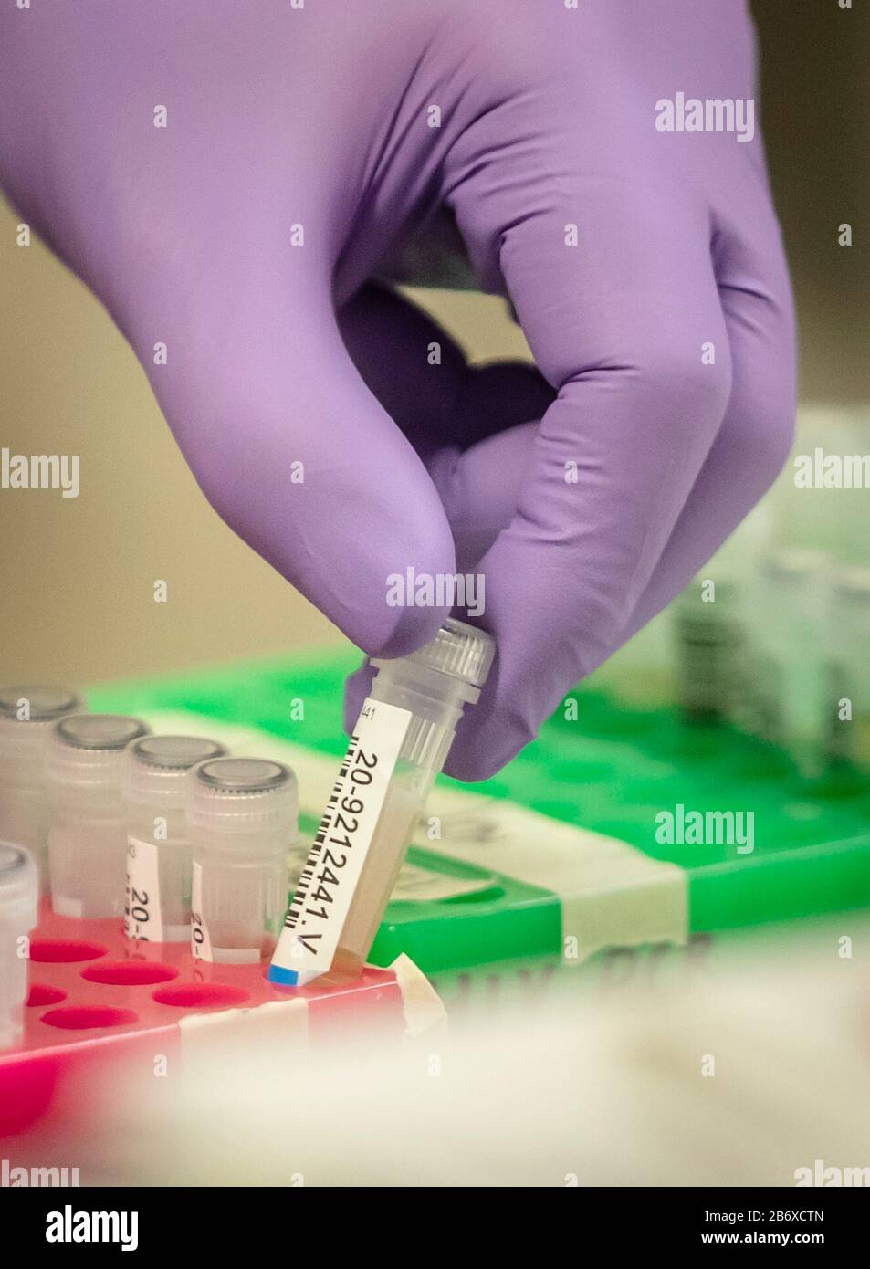 I campioni sono testati per virus respiratori durante una visita del Cancelliere Rishi Sunak ai laboratori di patologia presso l'infermeria generale di Leeds. Si tratta della stessa procedura che verrà utilizzata dal laboratorio quando inizia a ricevere campioni di coronavirus per l'analisi. Foto Stock