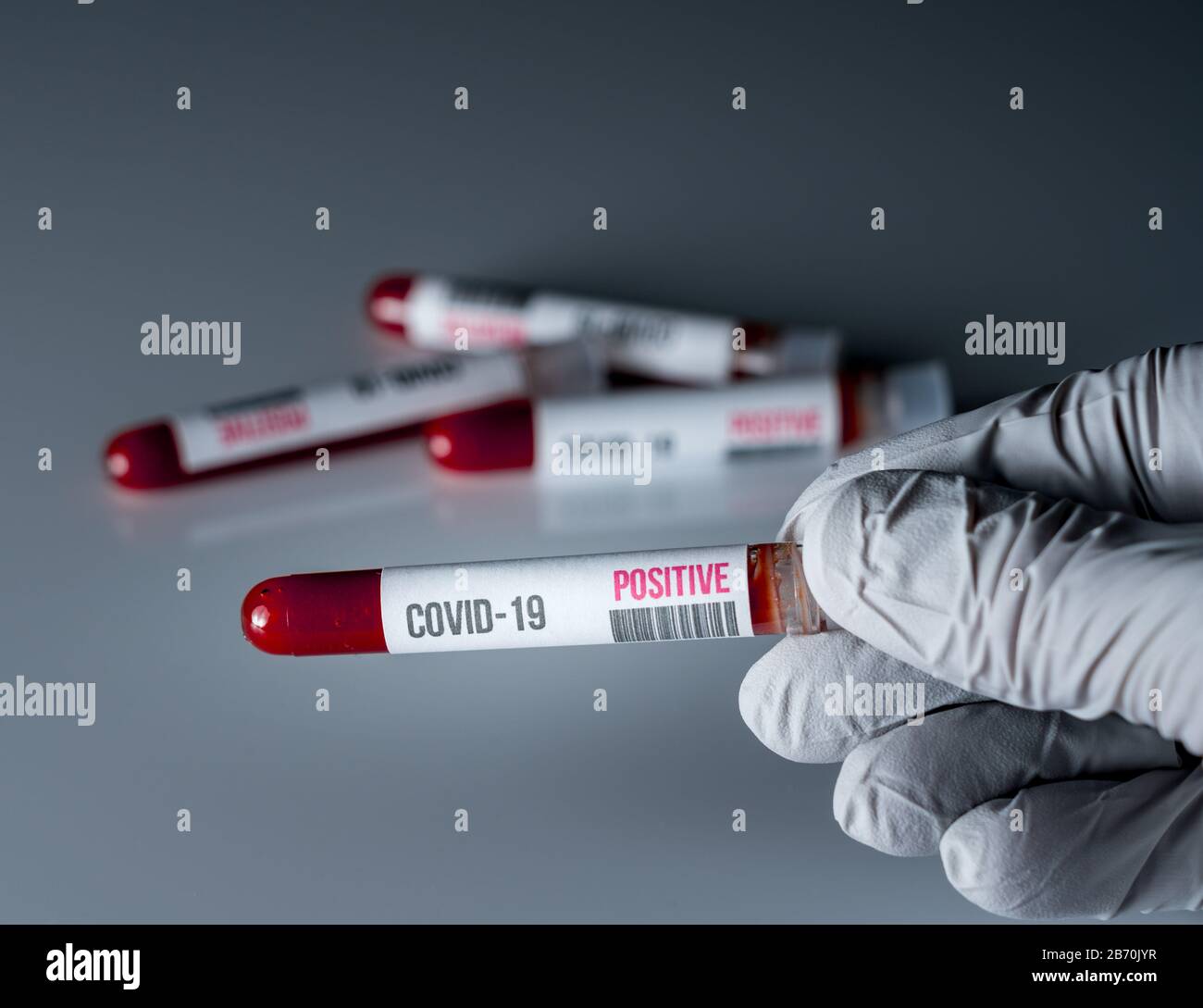 Guanto medico che contiene una provetta di sangue con un risultato positivo per il test per Covid-19 o coronavirus Foto Stock