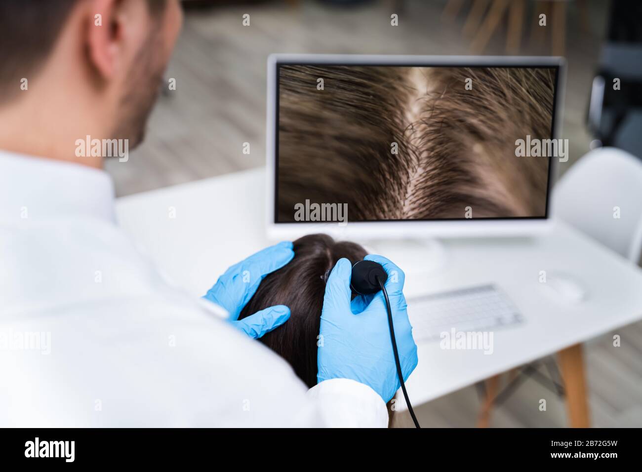 Close-up di dermatologo utilizzando Trichoscope per la caduta dei capelli il trattamento la sua clinica Foto Stock