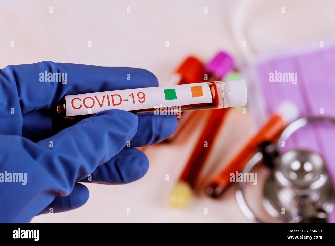COVID-19 dalla Cina il virus causa la polmonite atipica completa provette per analisi della conta sanguigna Foto Stock