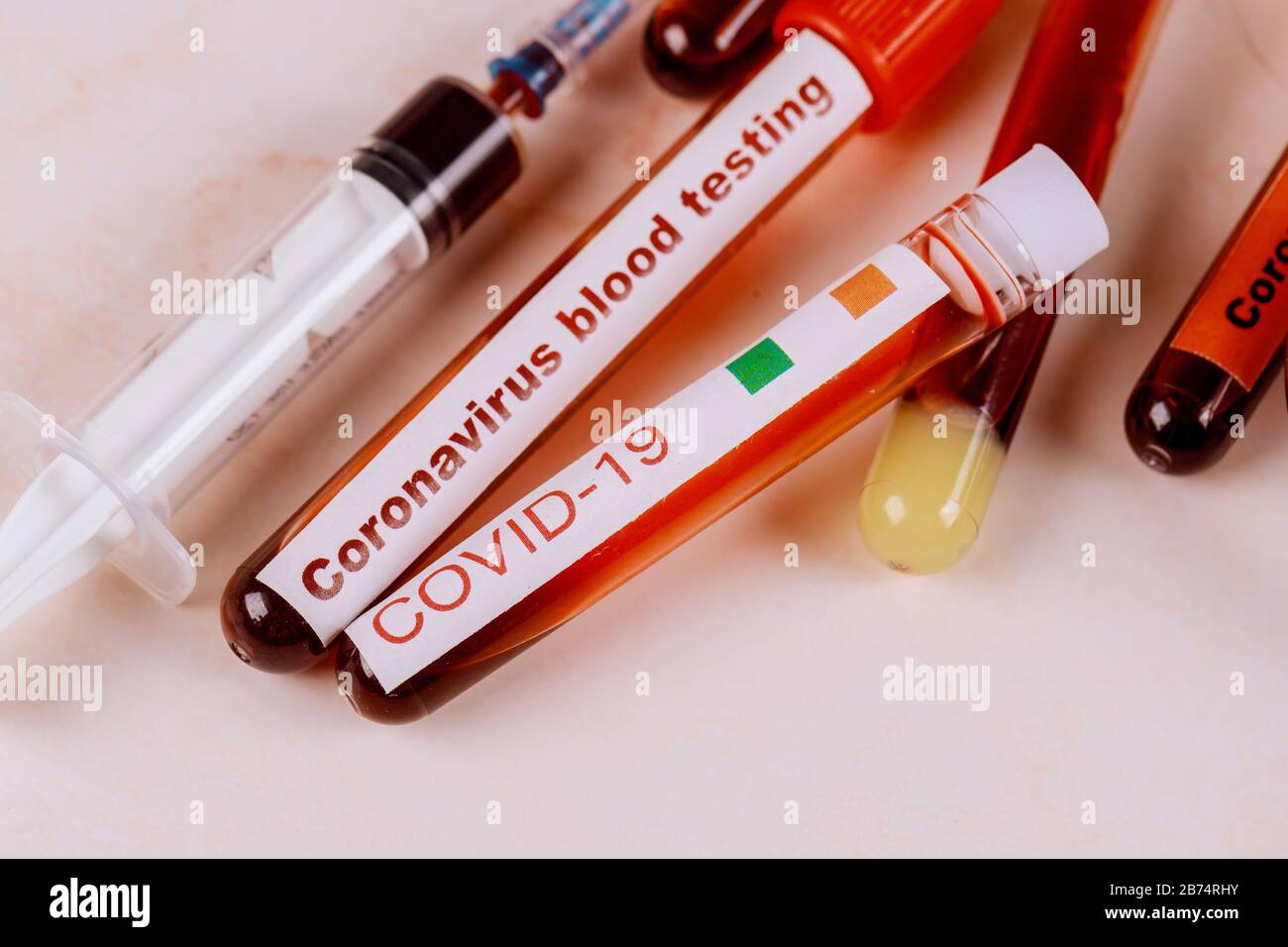 Definizione del virus COVID-19 Test del campione di sangue della sindrome respiratoria del Medio Oriente Foto Stock