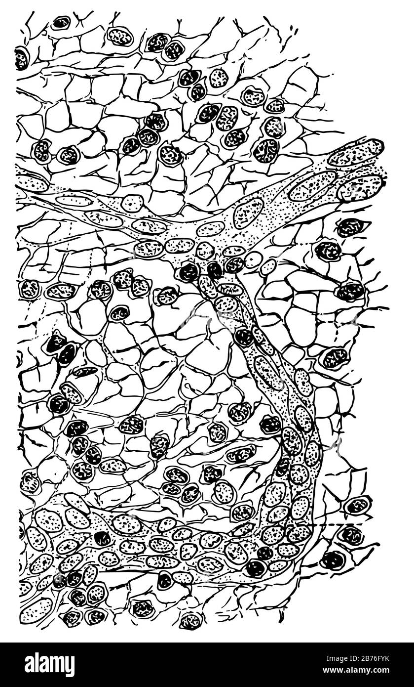 Questa illustrazione rappresenta Il Tessuto Connettivo di un ghiandole Linfatiche, un disegno a linea vintage o un'illustrazione dell'incisione. Illustrazione Vettoriale