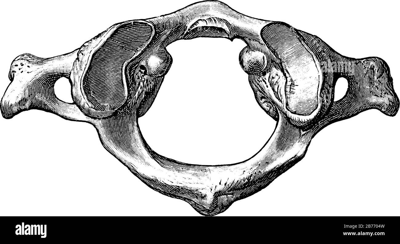 Figura dell'atlante, è la vertebra cervicale più superiore della colonna vertebrale, disegno a linee vintage o illustrazione dell'incisione. Illustrazione Vettoriale