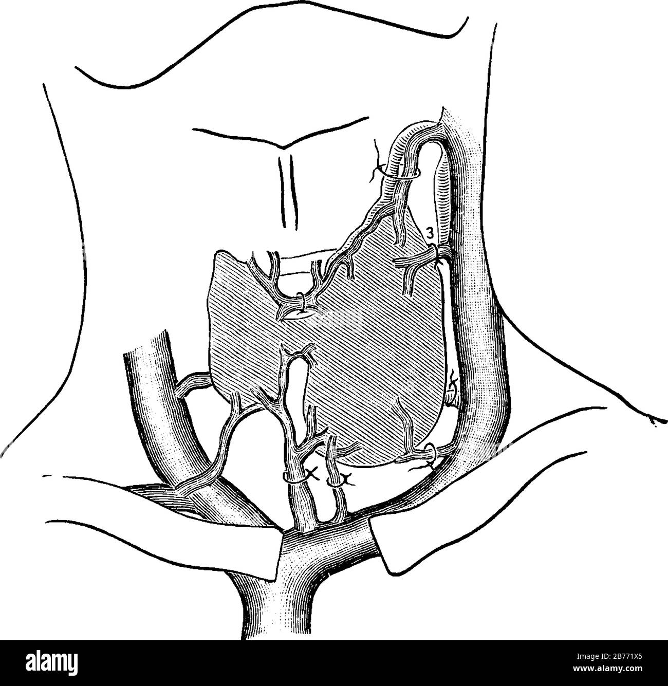 Le Vene tiroidee sono un vaso sanguigno che proviene dal plesso venoso ghiandolare della tiroide, dal disegno della linea vintage o dall'illustrazione dell'incisione. Illustrazione Vettoriale