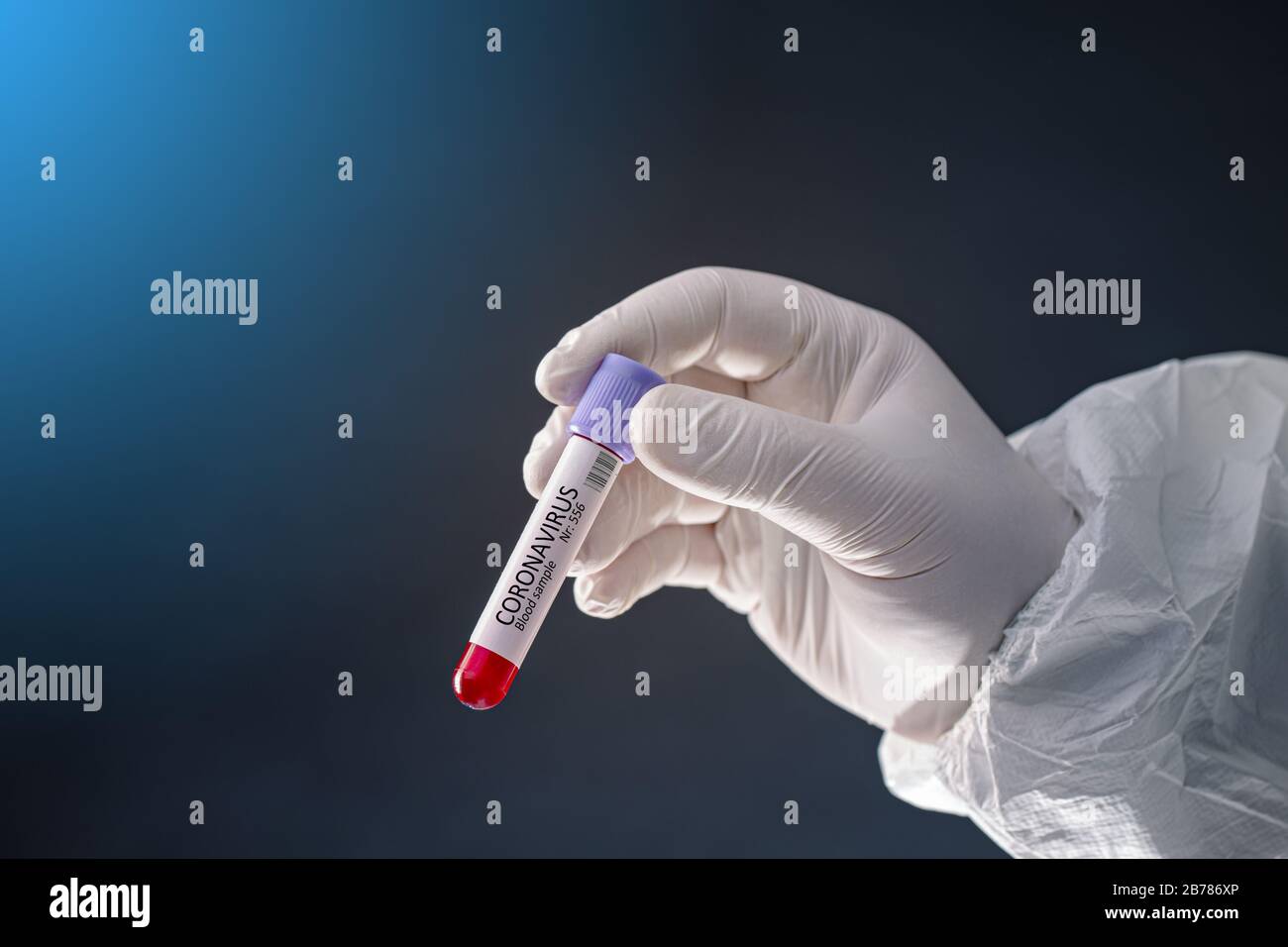 Pandemia globale con coronavirus COVID-19 provetta di sangue infetto in mano con coronavirus Covid 19 Foto Stock