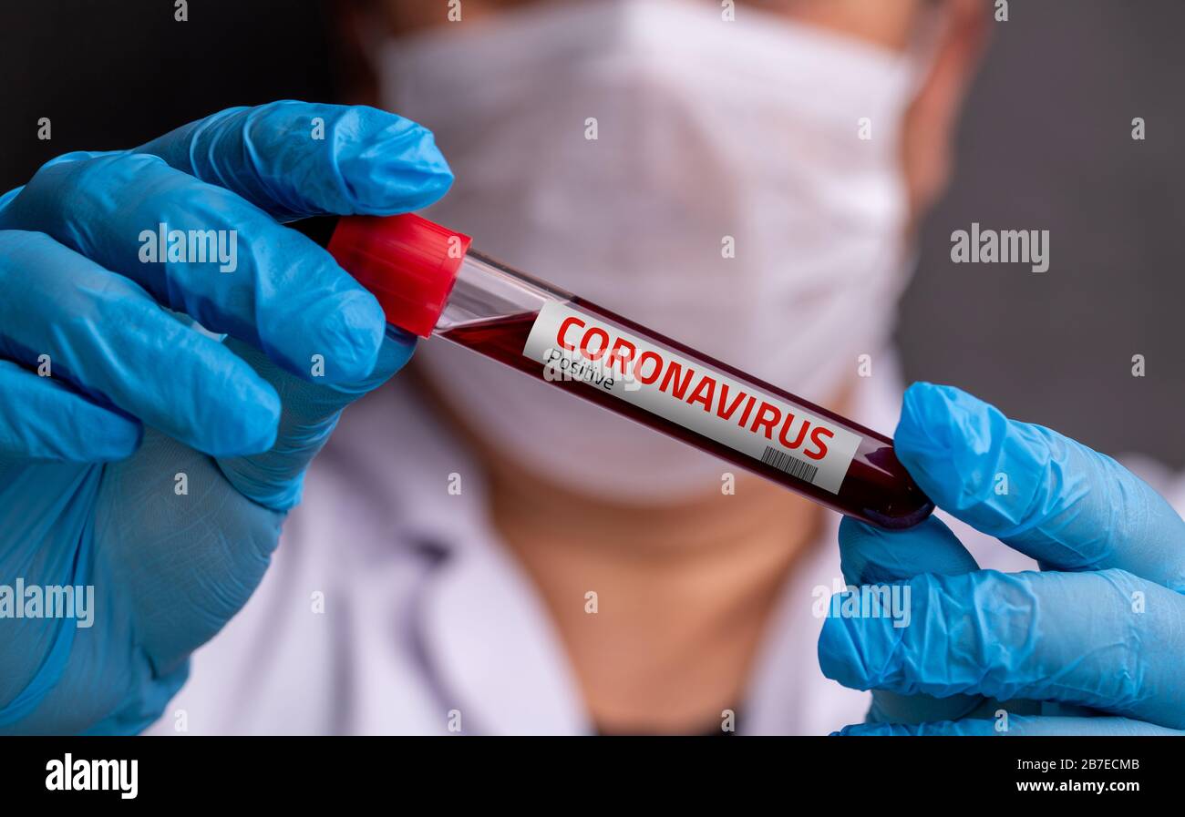 Infermiere che indossa una maschera respiratoria con un risultato positivo dell'analisi del sangue per il coronavirus Foto Stock