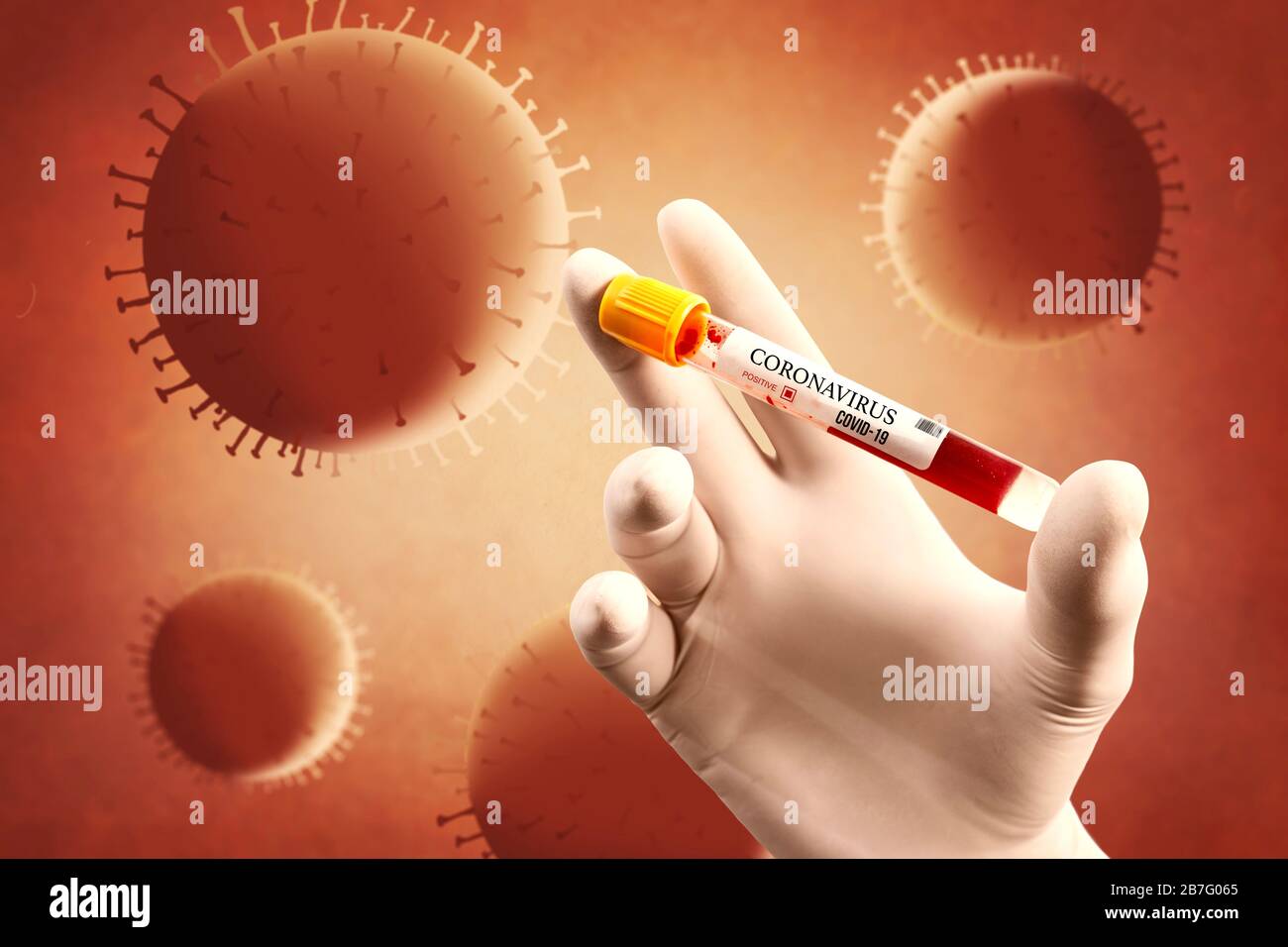 Campione di sangue in un pallone per analizzare il virus Corona e produrre il vaccino. Virus Corona superato Foto Stock