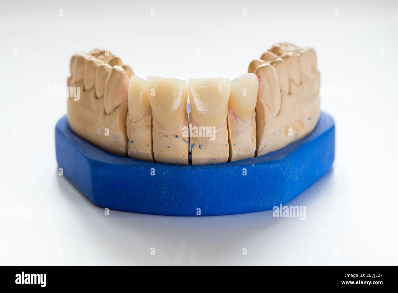 Modello in gesso dentale in laboratorio dentista - primo piano. Dentiere in  gesso con denti in porcellana isolati su sfondo bianco - spazio copia Foto  stock - Alamy