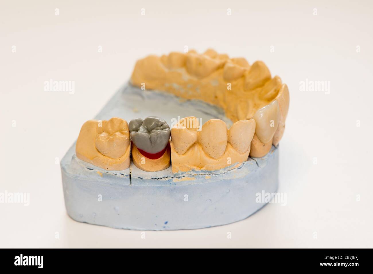 Modello in gesso dentale in laboratorio dentista - primo piano. Dentiere in gesso con denti in porcellana isolati su sfondo bianco - spazio copia Foto Stock