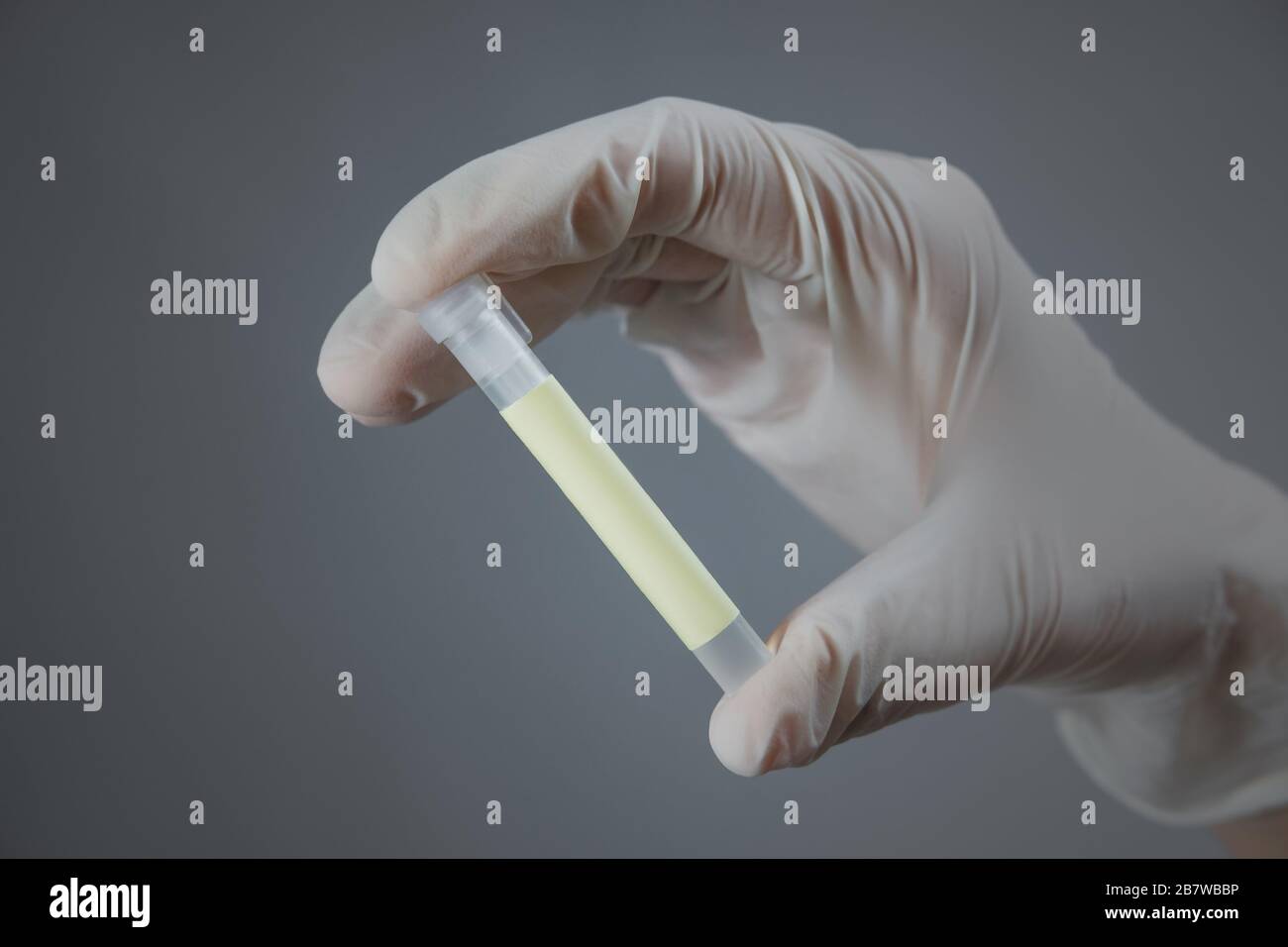 Indossare un guanto medico con un contenitore da laboratorio. Concetto di vaccinazione, ricerca antivirus o sviluppo del trattamento Foto Stock