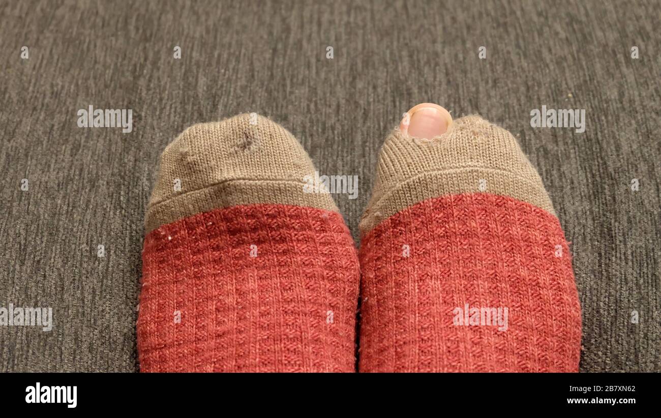 Un paio di calze, con un foro alla punta del calzino destro, che mostra la punta grande. Foto Stock