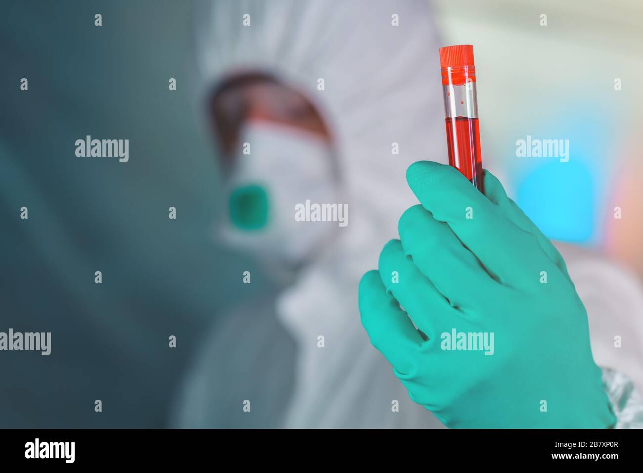 Epidemiologo con campione di sangue nella provetta, fuoco selettivo Foto Stock