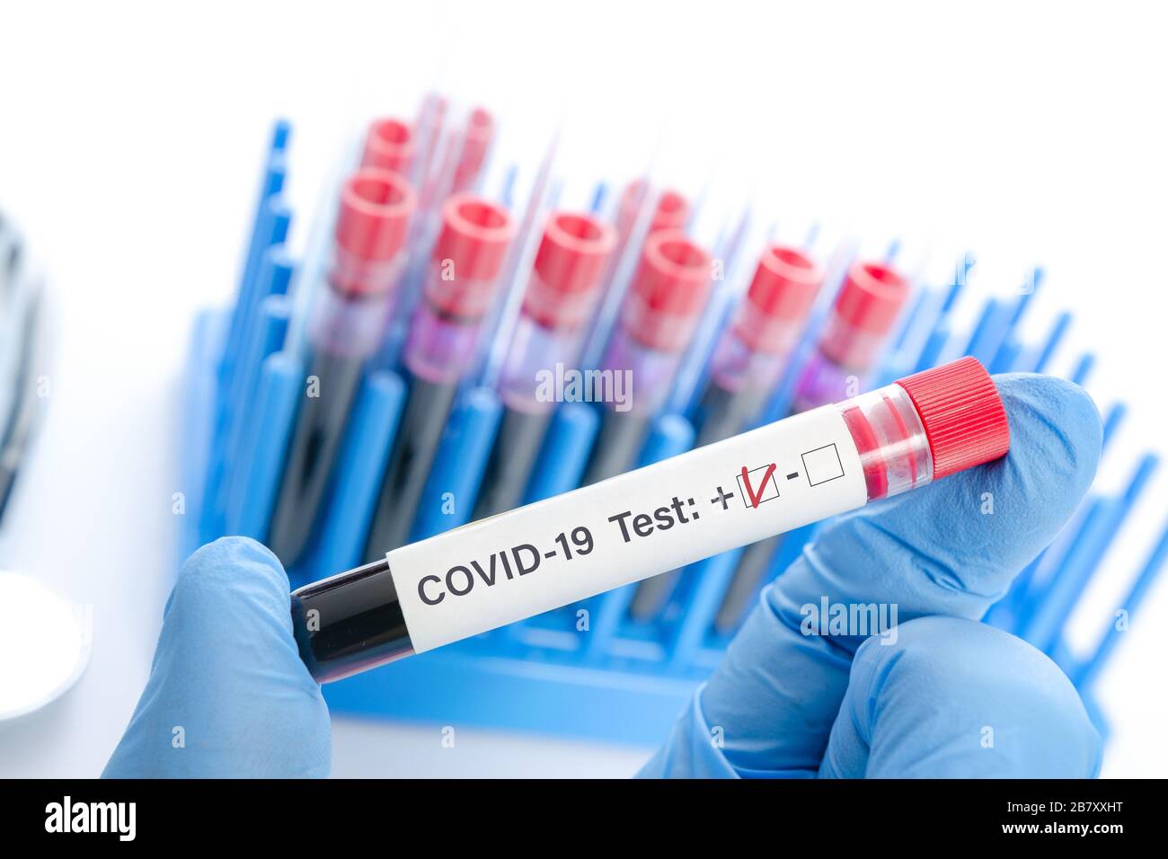 Coronavirus Infectious Concept - il medico tiene in mano il campione di sangue COVID -19 test positivo in laboratorio Foto Stock