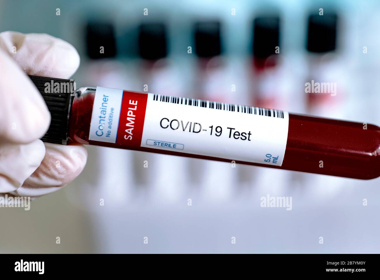 Test per la presenza di coronavirus. Provetta contenente un campione di sangue per la diagnosi di COVID-19. Tubi sullo sfondo. Foto Stock