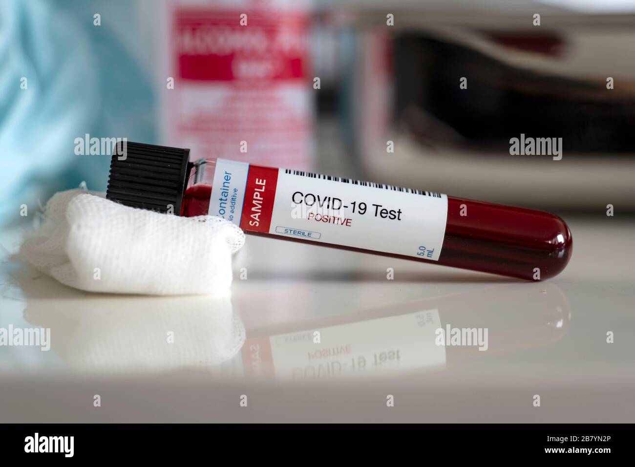 Test per la presenza di coronavirus. Provetta contenente un campione di sangue risultato positivo per COVID-19 Foto Stock