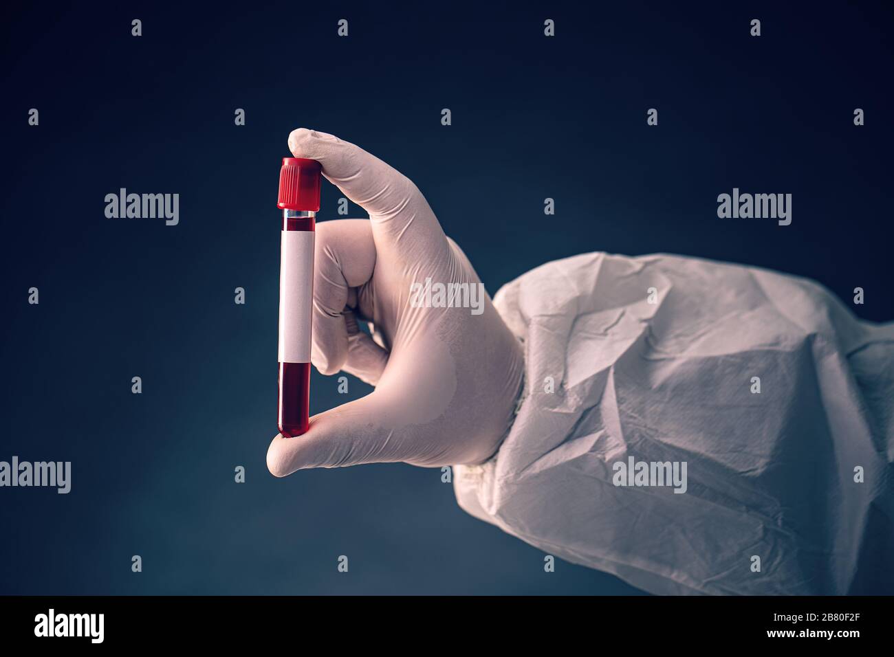 Provetta con supporto manuale con plasma sanguigno pronto per l'analisi Foto Stock