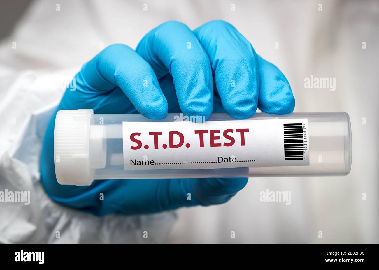 Test con tampone STD Foto Stock