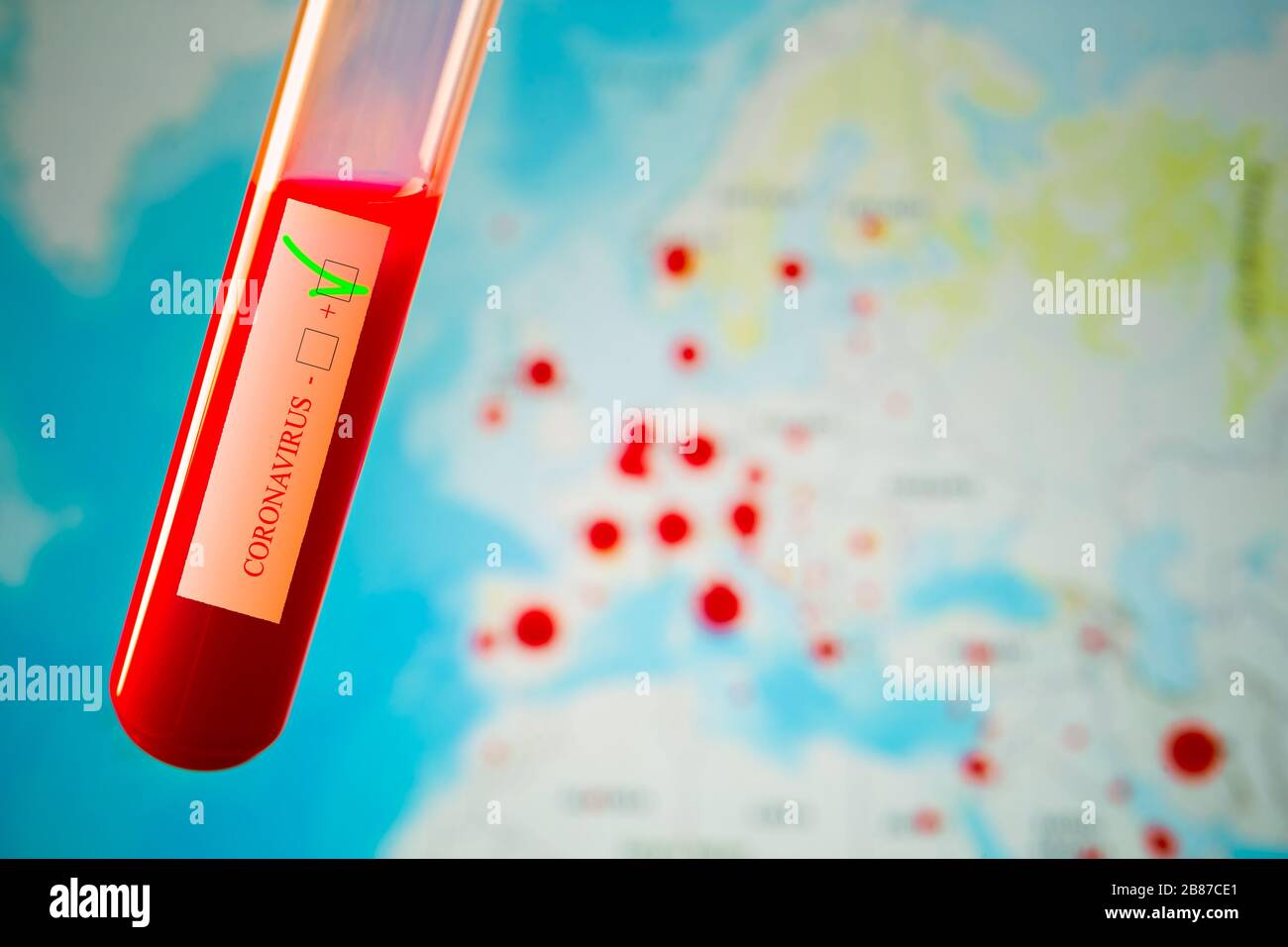 Coronavirus pandemico, test positivo nCoV 2019, mappa europea sullo sfondo con casi di diffusione Foto Stock