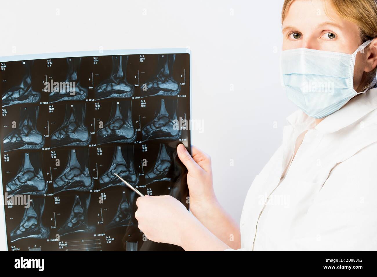 Il medico indica l'immagine a raggi X, Austria Foto Stock