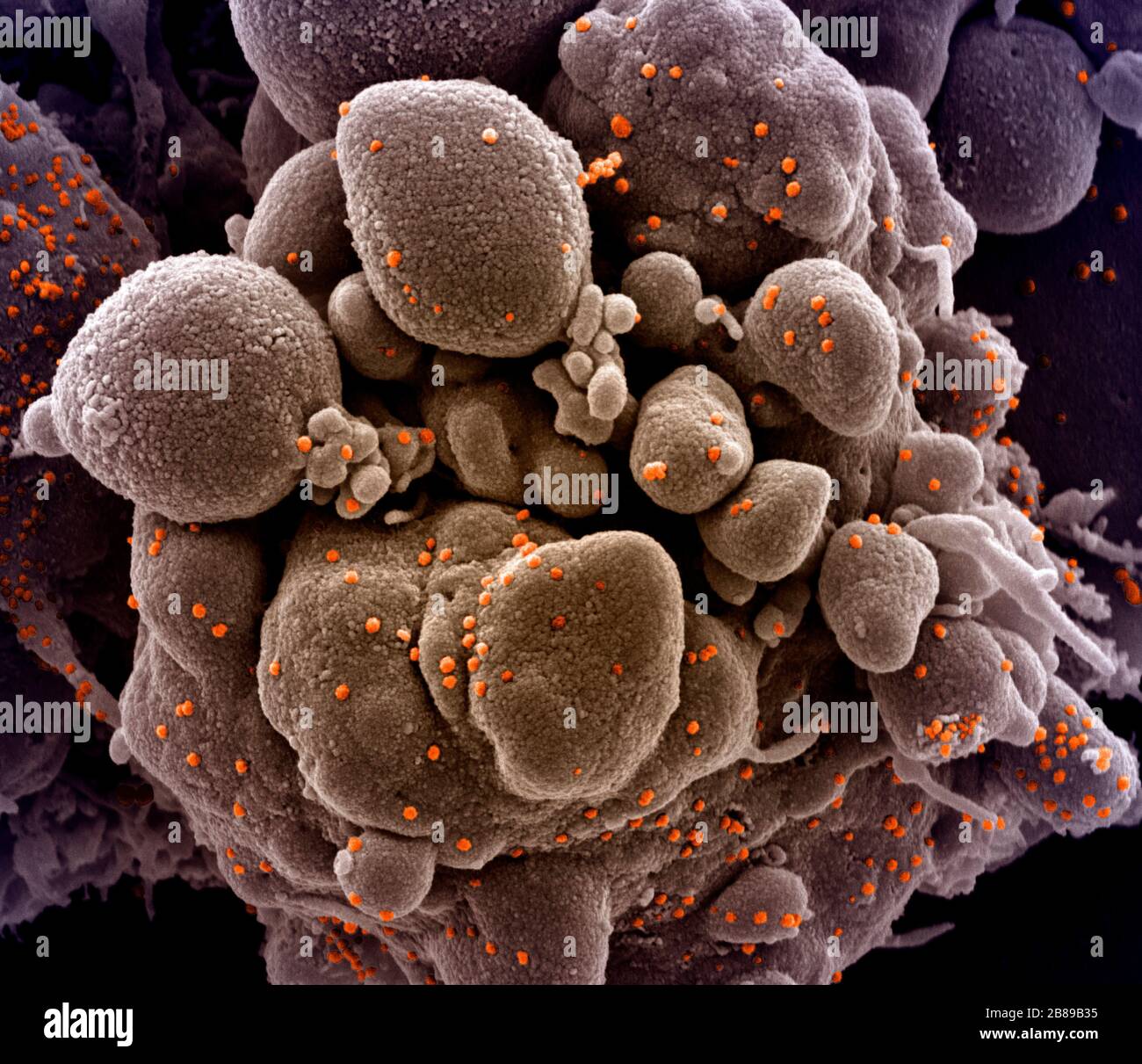 Una micrografia elettronica a trasmissione di COVID-19, nuovo coronavirus, una cellula apoptotica fortemente infettata con particelle di virus SARS-COV-2, isolata da un campione di paziente presso il NIAID Integrated Research Facility 19 marzo 2020 a Fort Detrick, Maryland. Foto Stock