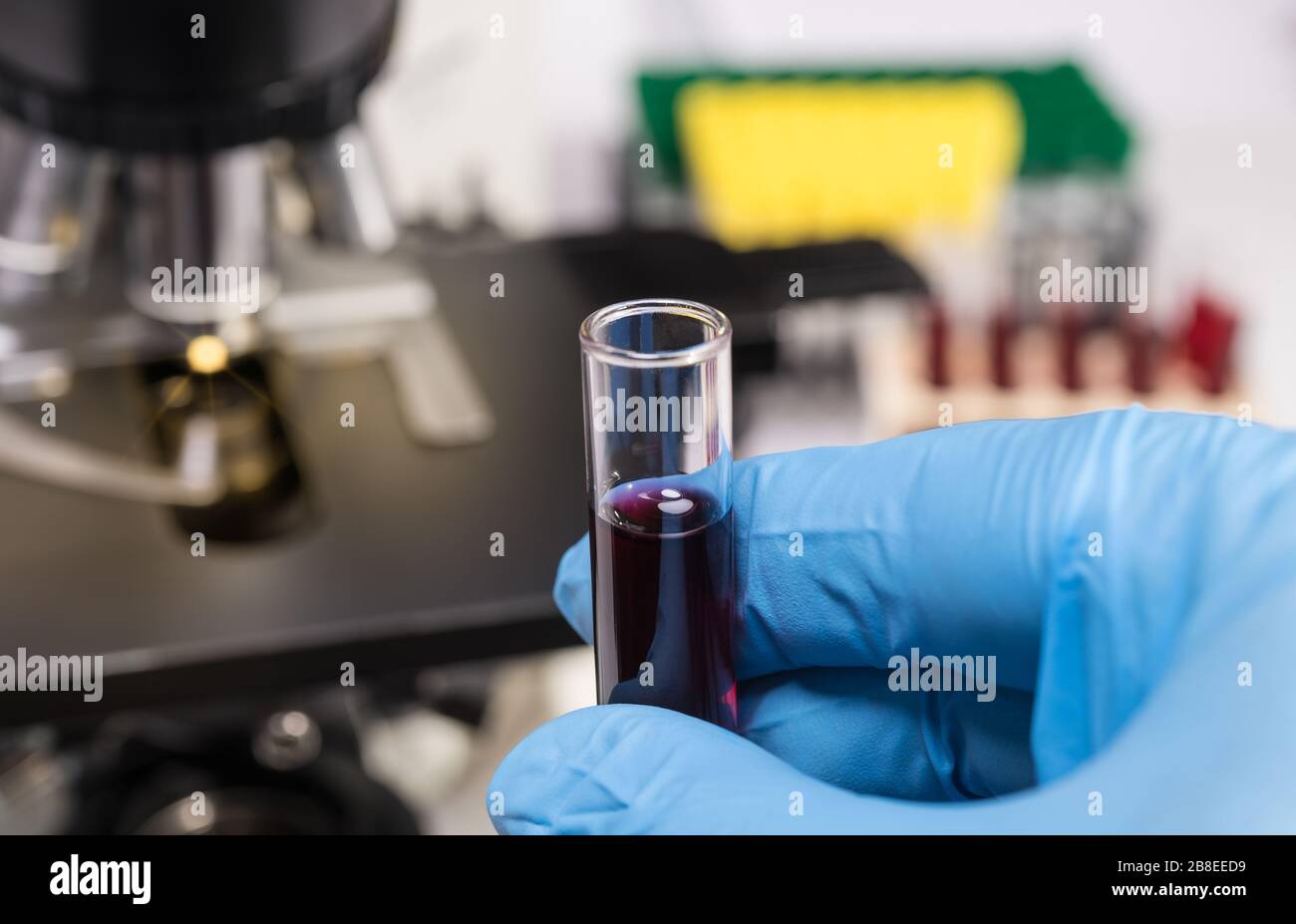 Ricerca medica sul coronavirus. Mano nel guanto blu contenente il liquido rosso nel vetro di prova. Specialista analisi del campione clinico. Microscopio ottico diagnostico. Foto Stock