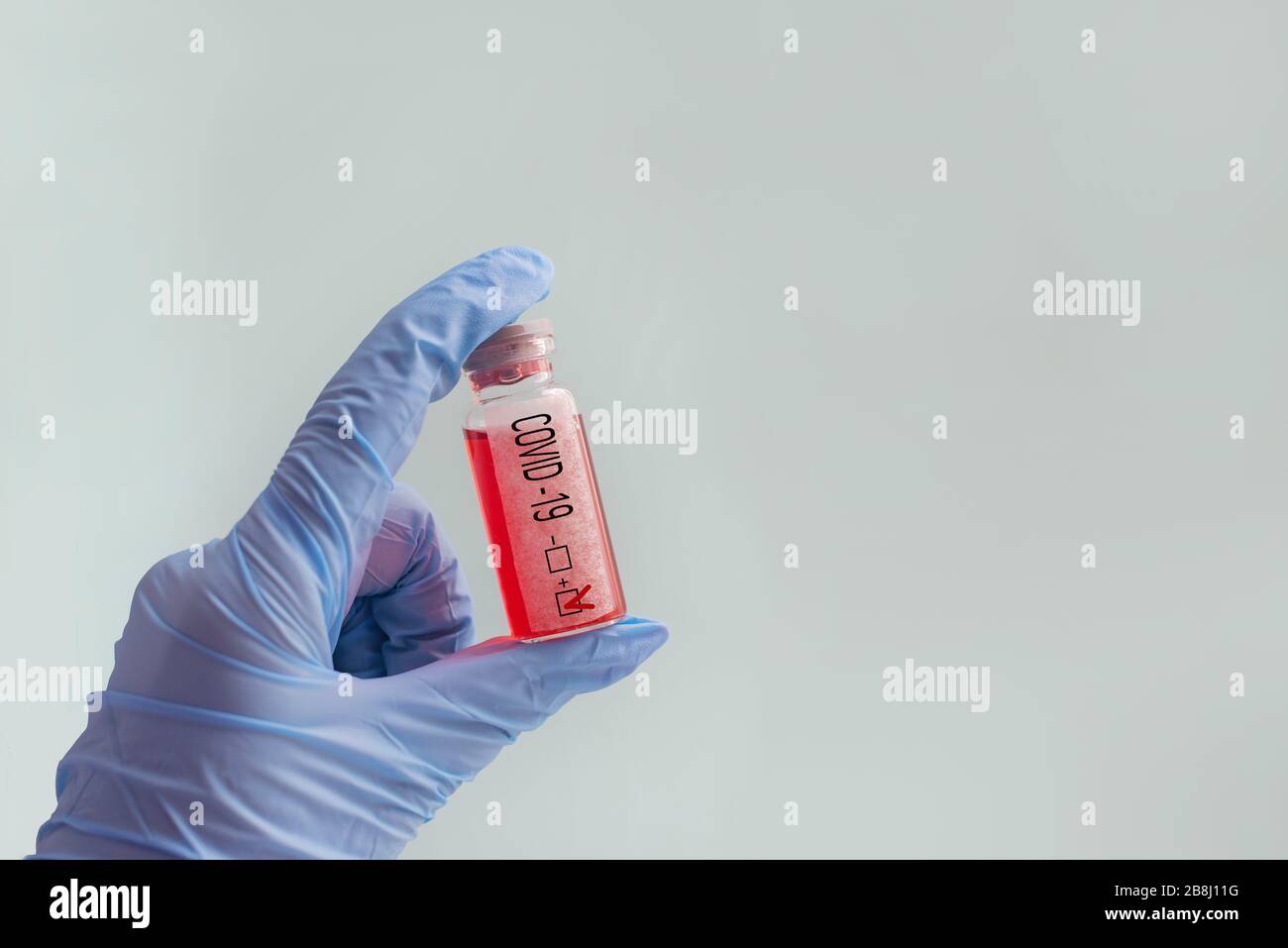 test per il coronovirus in un'epidemia con probaika e test del sangue in labarotorium Foto Stock