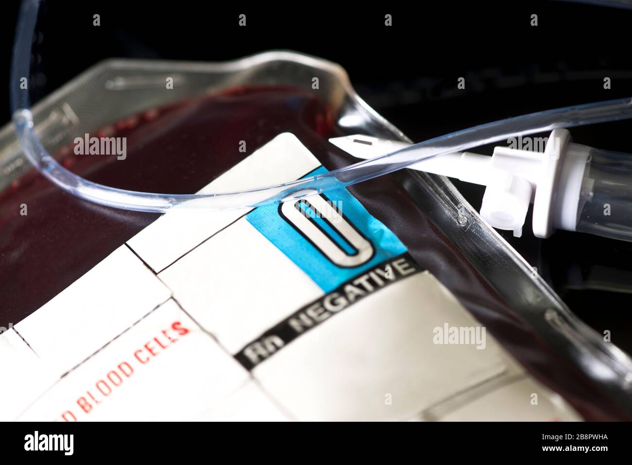 O unità del sangue donatore negativa con catetere EV e tubo. Foto Stock