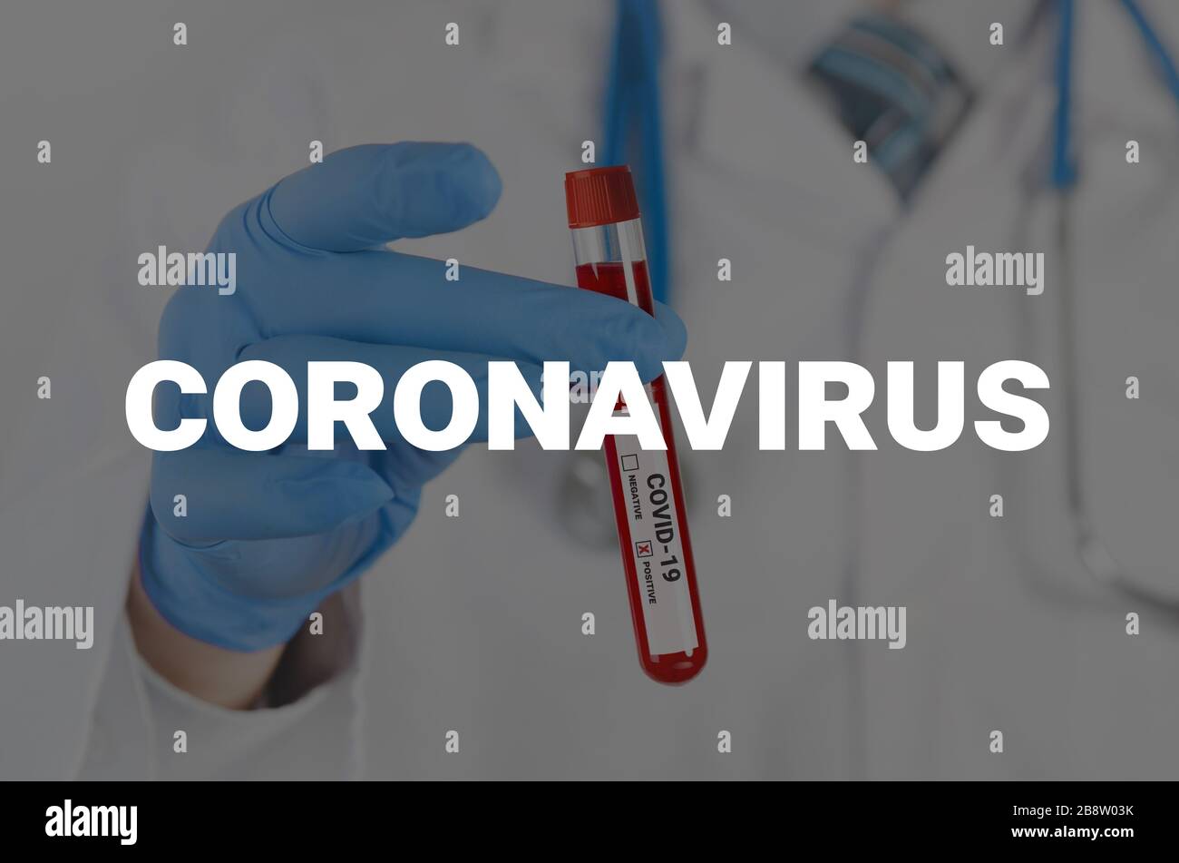 Il medico tiene una provetta. Test del sangue, test positivo del virus corona Foto Stock