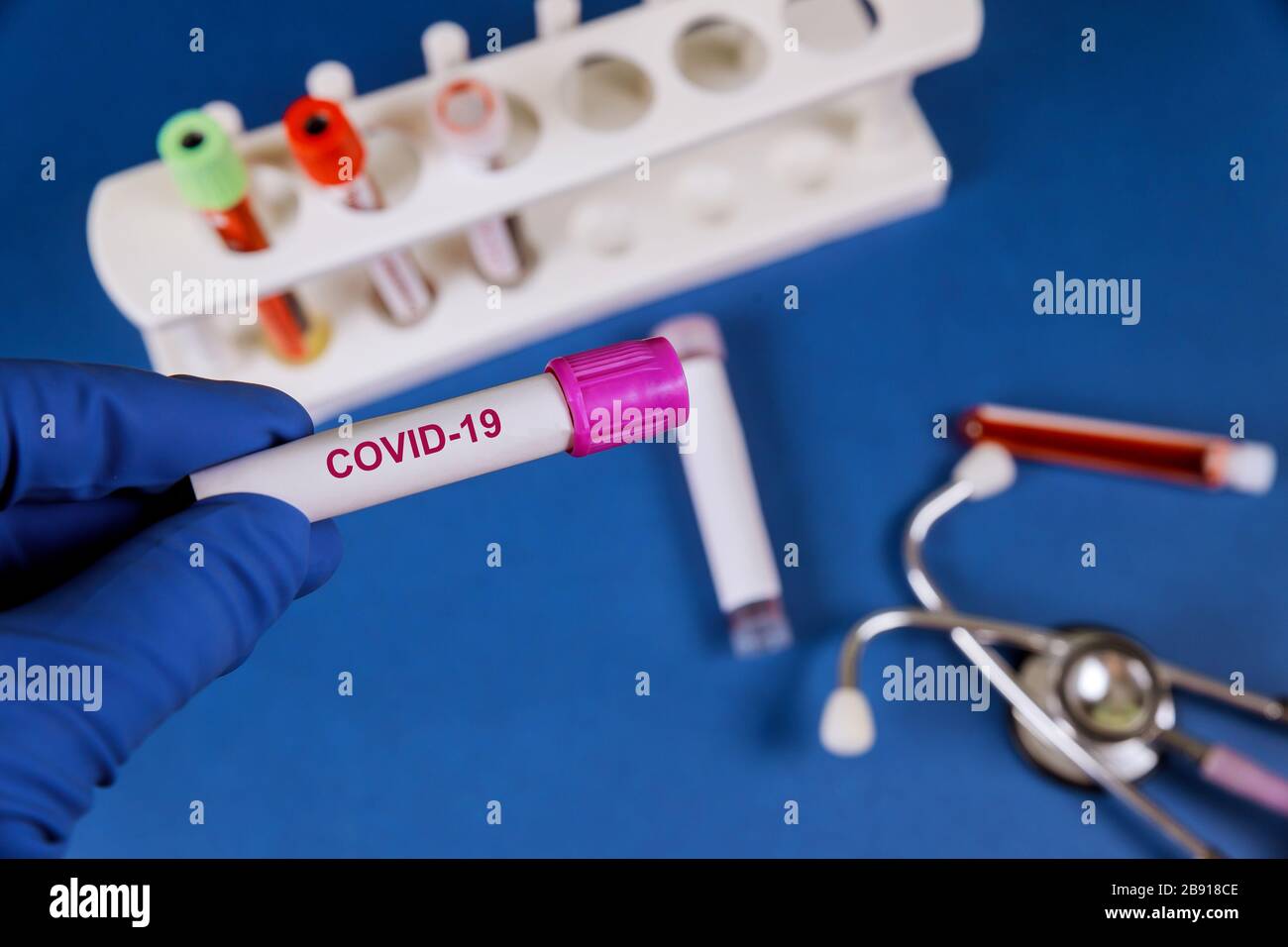 Provetta per il controllo del coronavirus su un modulo di richiesta di analisi del sangue per covid-19 Foto Stock