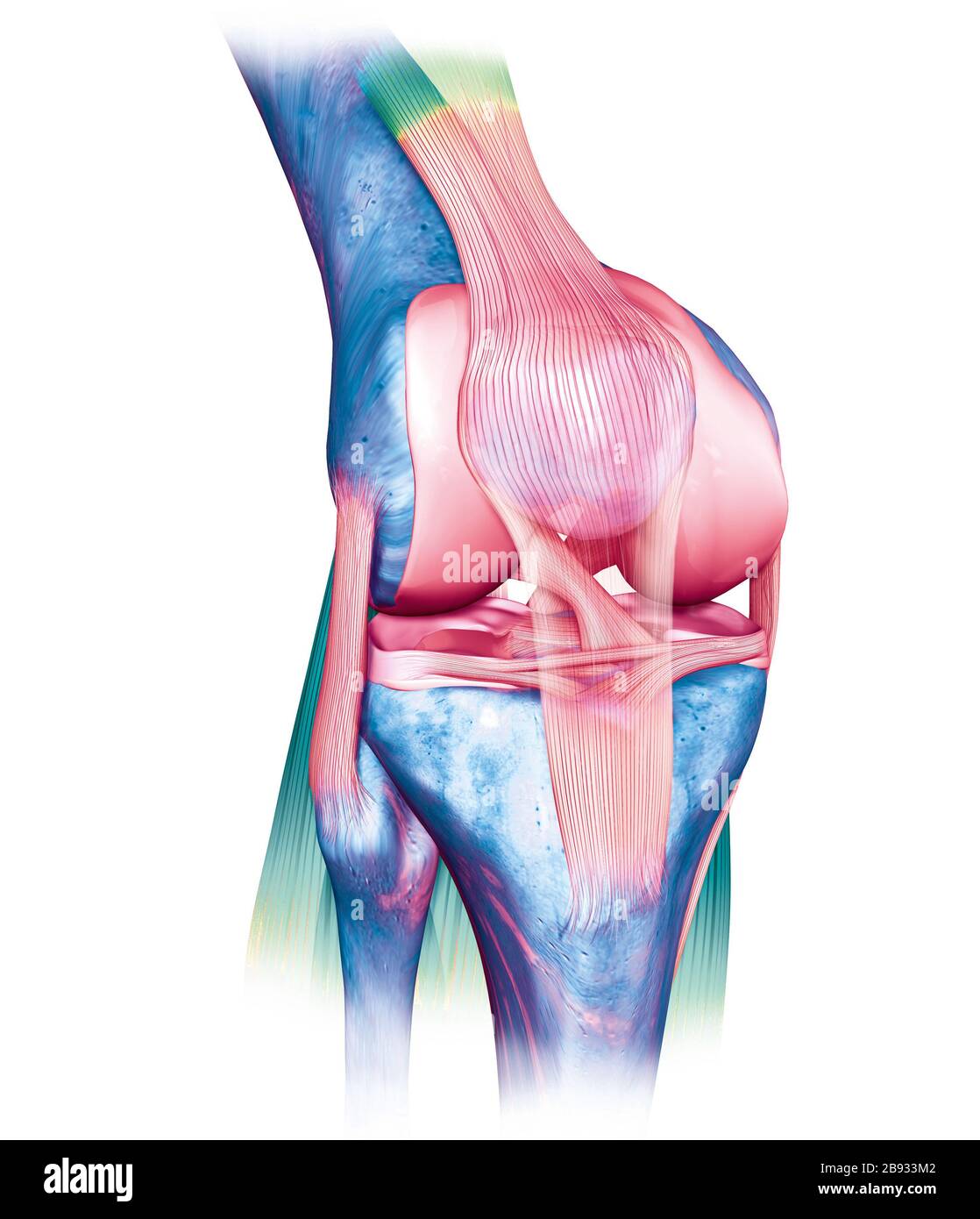 Illustrazione 3D medica accurata che mostra un'articolazione dolorosa del ginocchio con legamento crociato anteriore e posteriore evidenziato, menisco, cartilagine articolare, Foto Stock