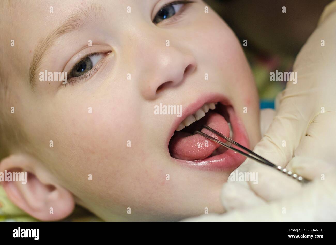 Un bambino ad un therapist di discorso. Massaggio di terapia del parlato Foto Stock