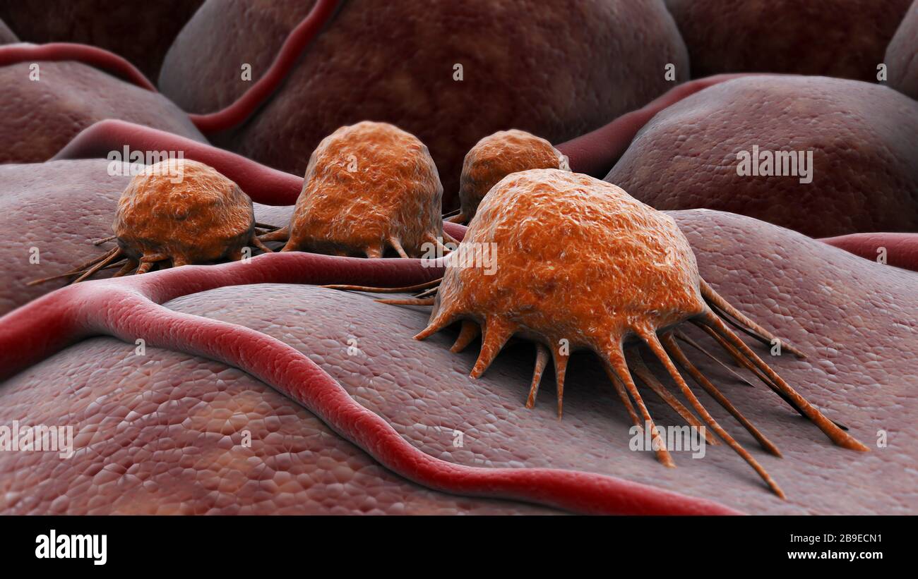 Immagine concettuale del cancro virus. Foto Stock