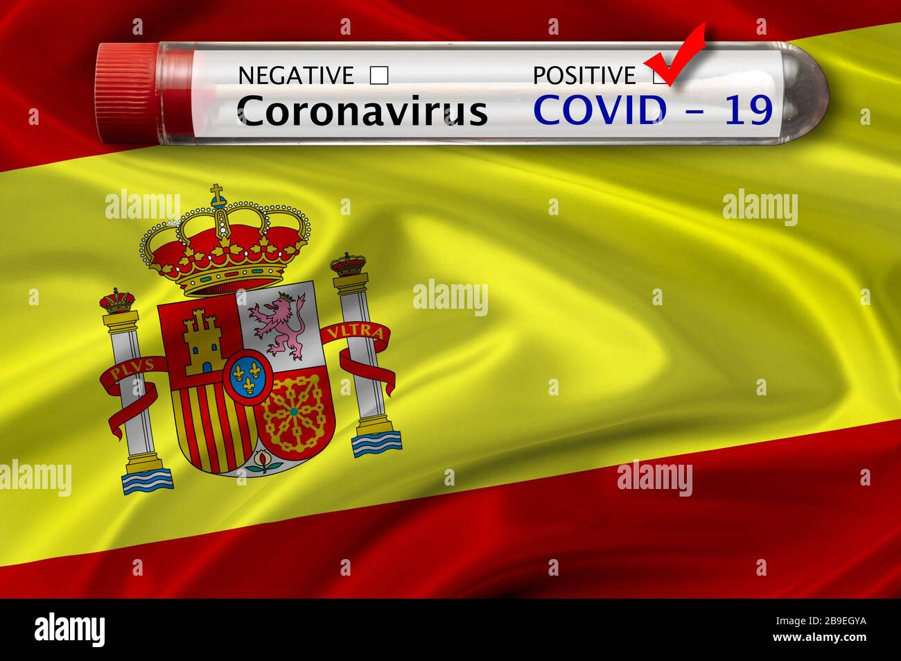 Infezione da coronavirus, Covid-19 e Spagna bandiera in background Foto Stock