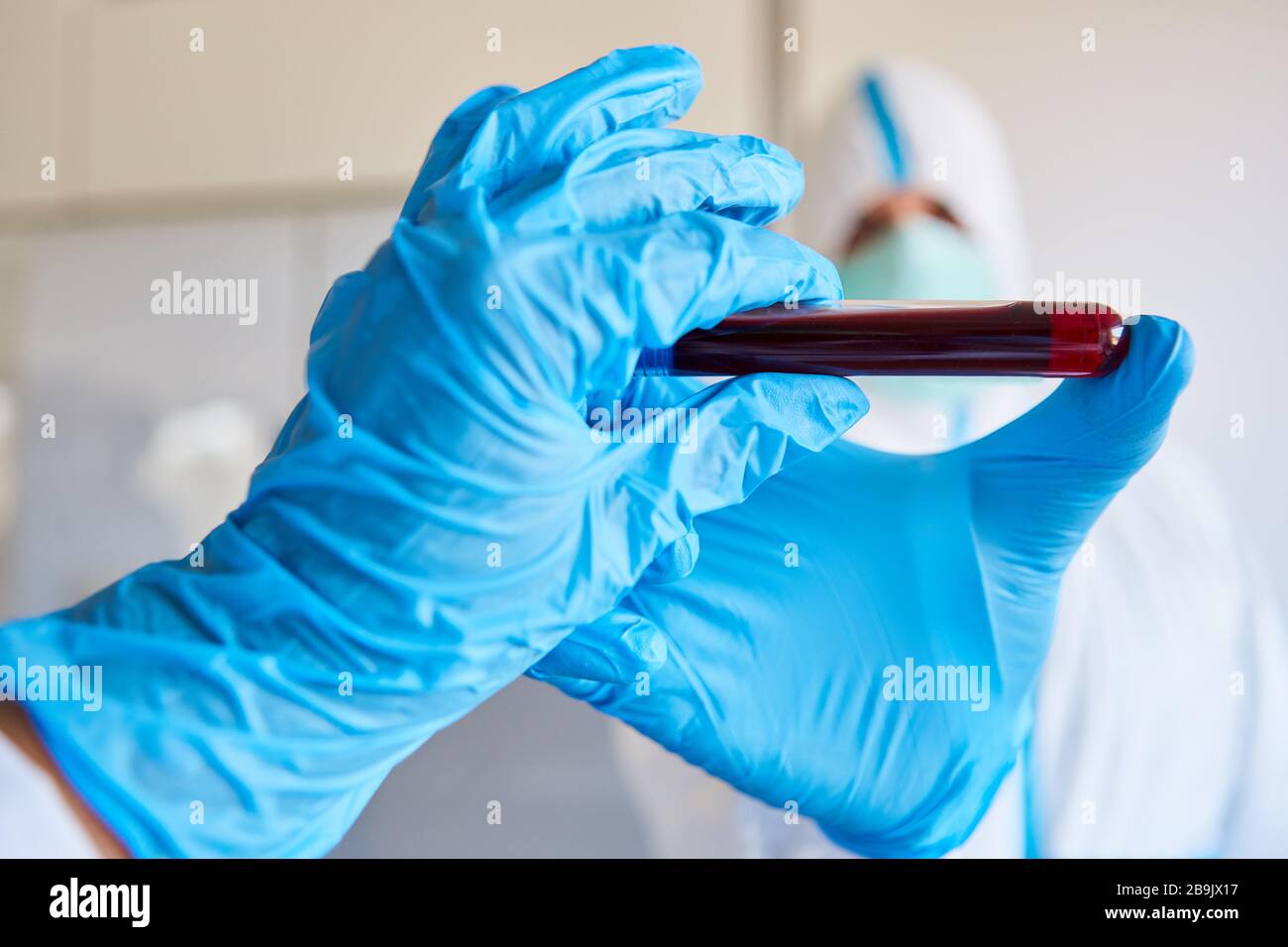 Analisi del sangue per esami del sangue su Covid-19 per la ricerca di vaccini in laboratorio Foto Stock