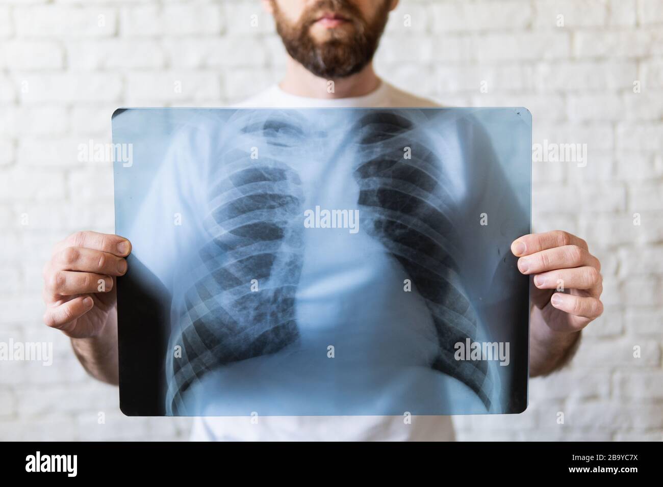 Giovane uomo bearded che tiene film di raggi X di polmoni e cuore davanti al suo petto, sfondo bianco Foto Stock