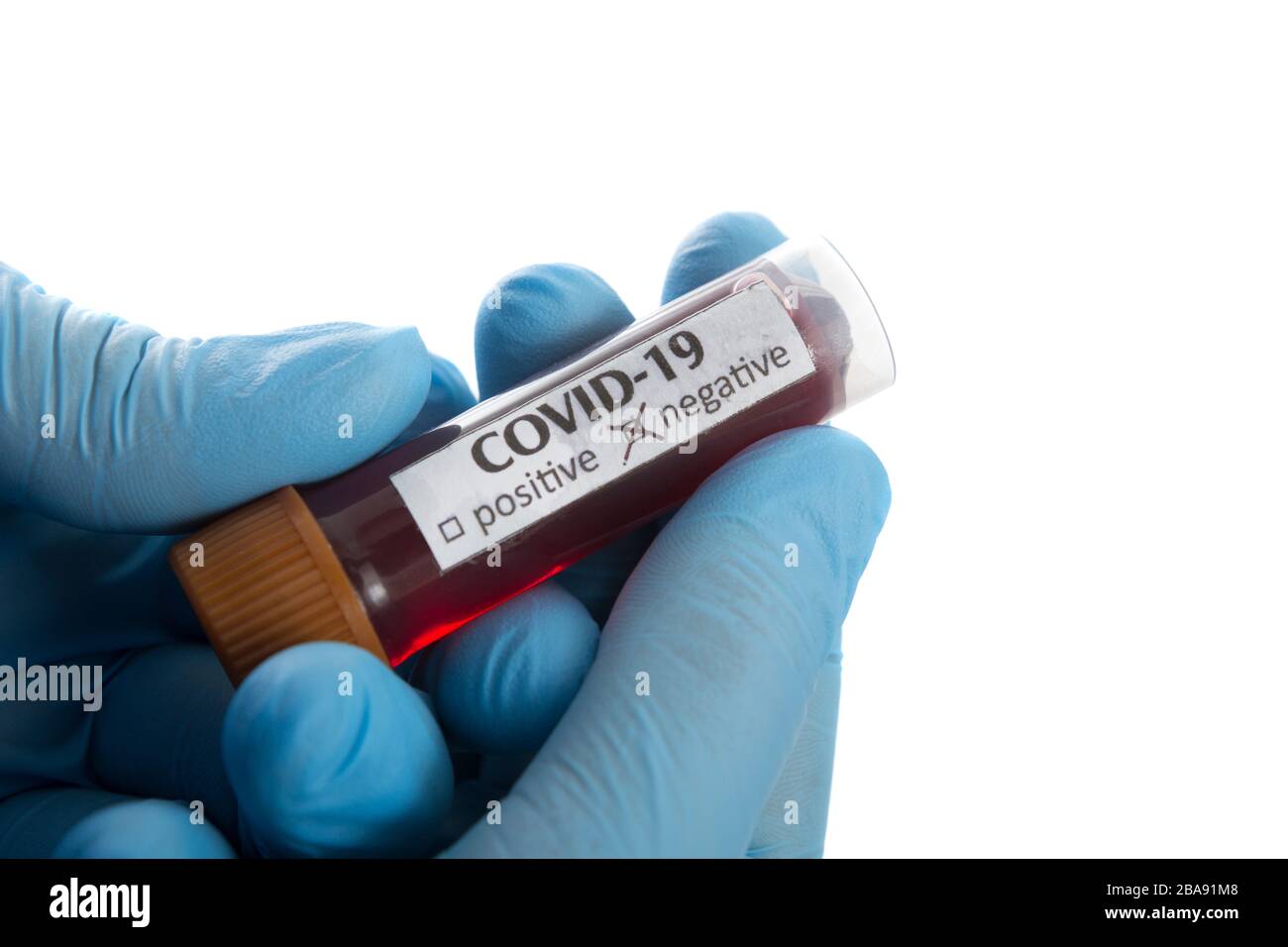 Provetta per analisi del sangue in una mano medica con guanti medici blu. Foto Stock